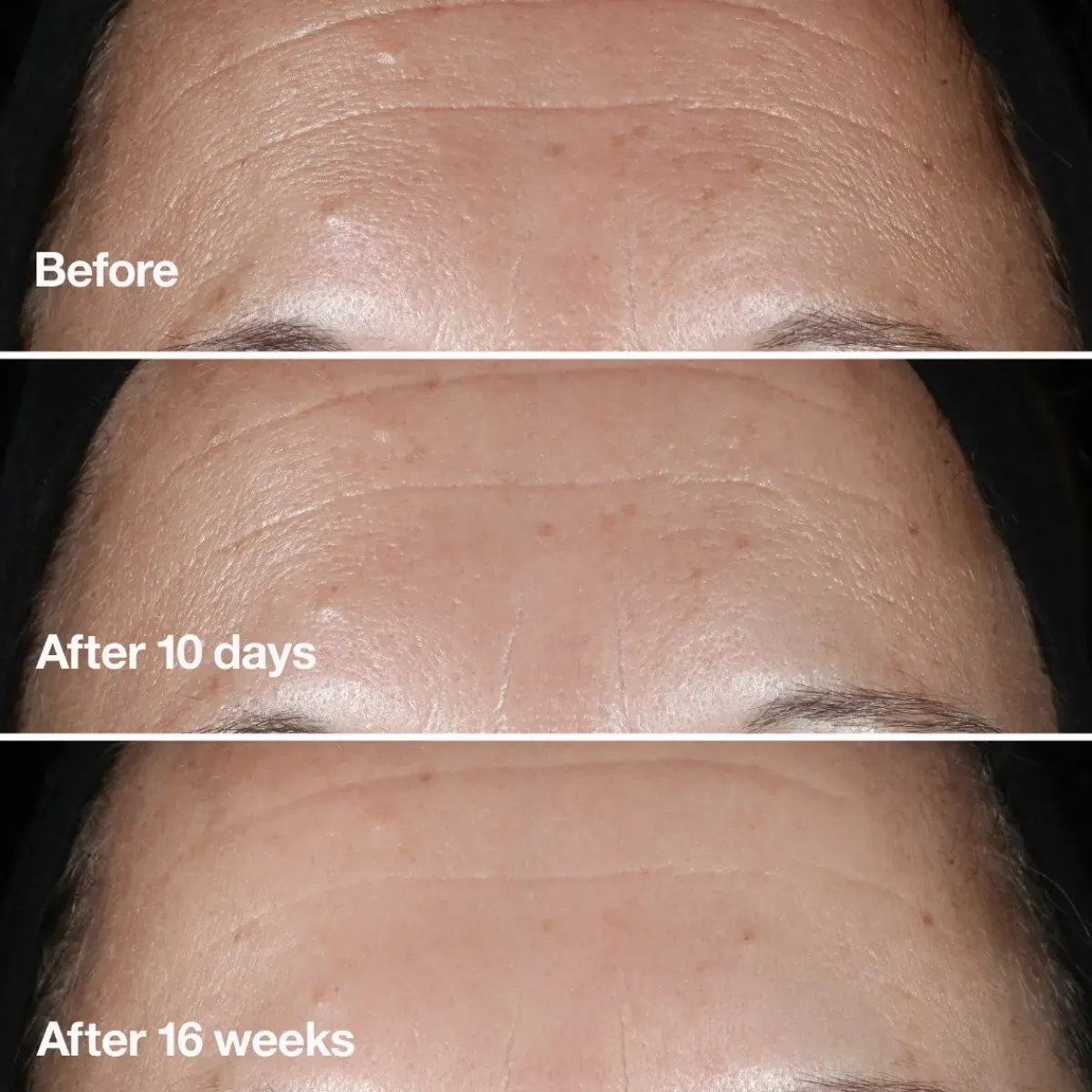 Clinique Serum>Smart Clinical Repair Serum