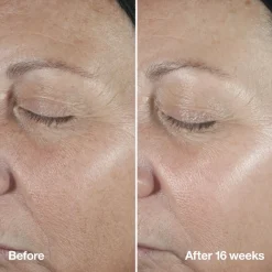 Clinique Serum><noscript><img width=