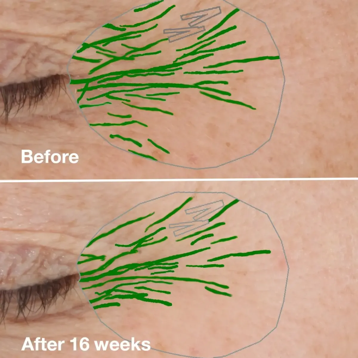 Clinique Crème De Jour>Smart Clinical Repair Wrinkle Correcting Cream
