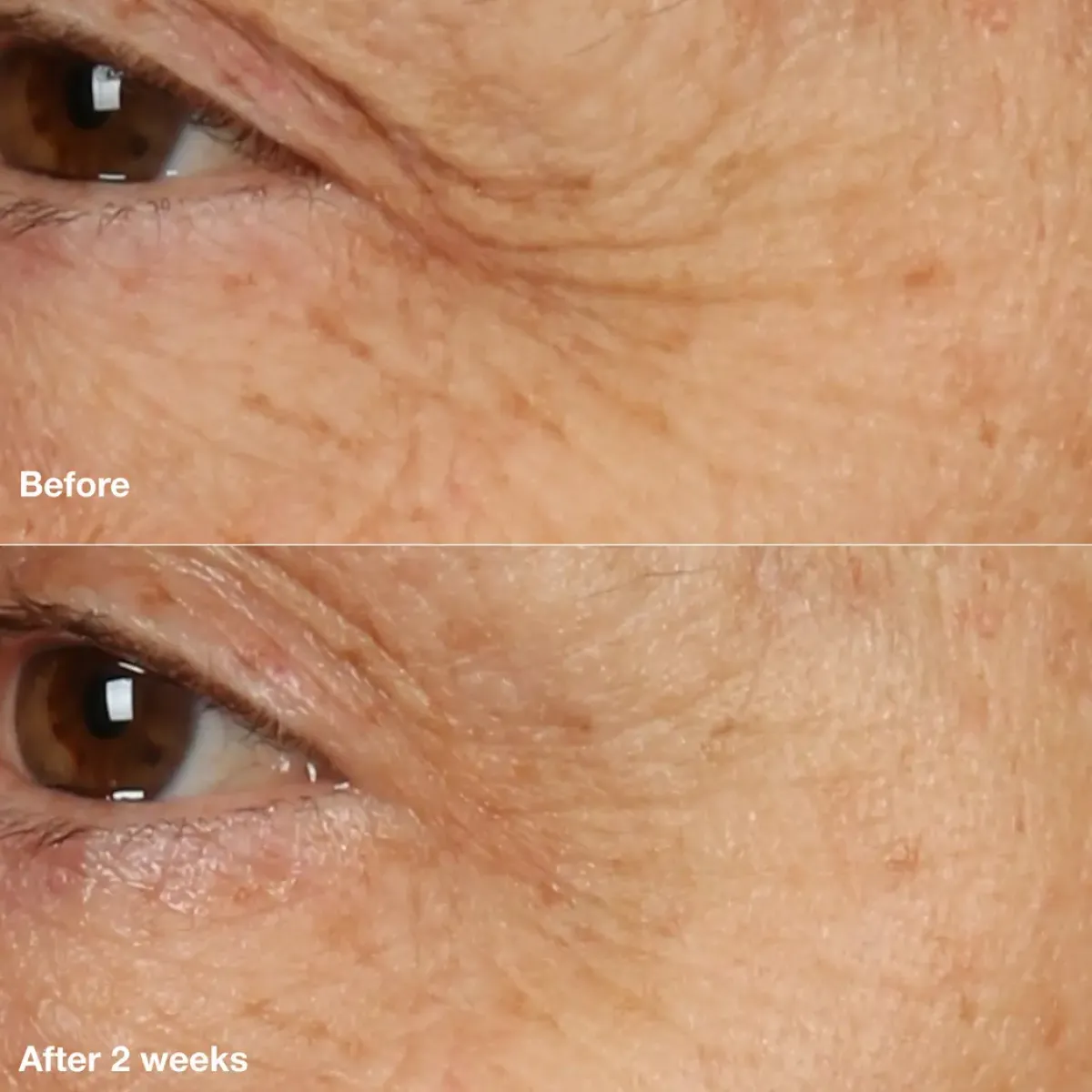 Clinique Crème De Nuit>Smart Clinical Repair Overnight Recovery Cream & Mask