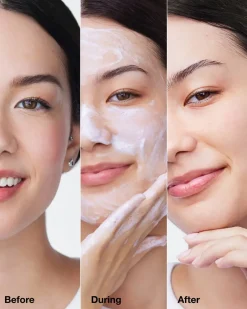 Clinique Nettoyage><noscript><img width=