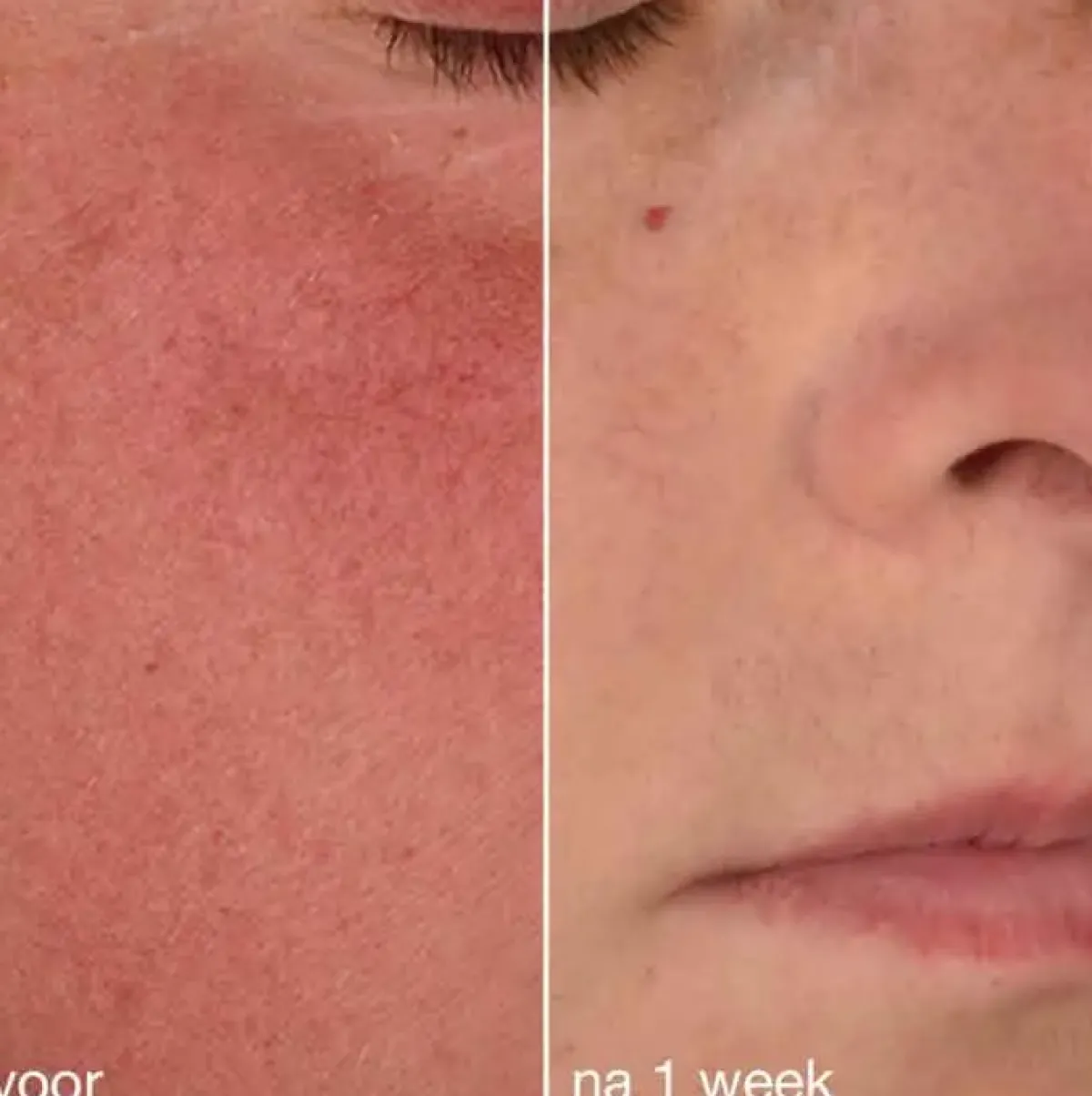 Dermalogica Crème De Jour>Stabilizing Repair Cream