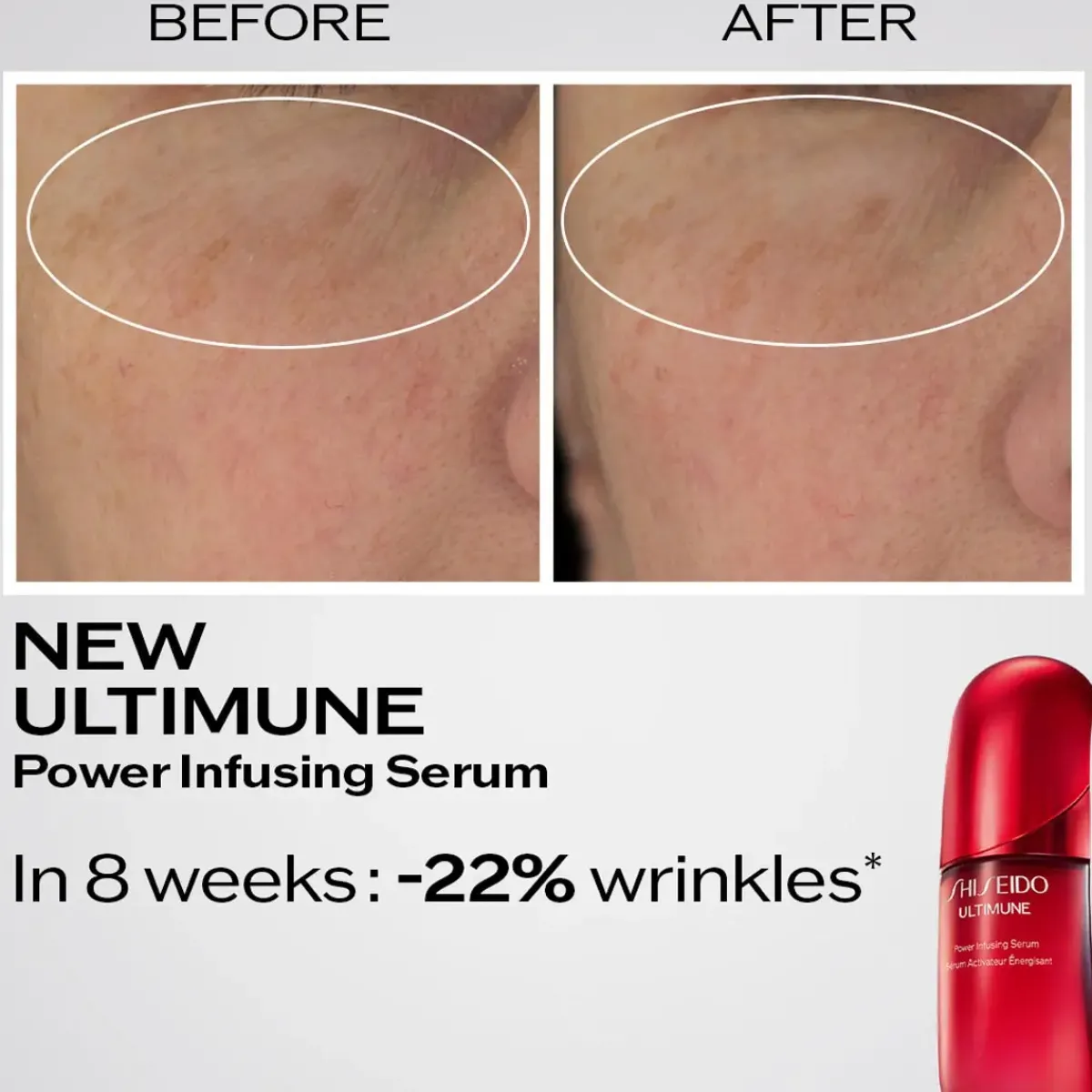 Shiseido Serum>Ultimune Power Infusing Serum Refill
